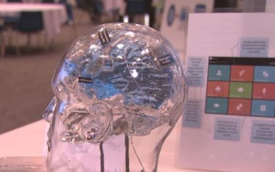 پروتز حافظه (Prosthetic Memory)