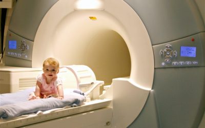 آیا تصاویر MRI میتوانند گزینه مناسبی برای پیش بینی اختلال طیف اوتیسم در نوزادان باشند؟