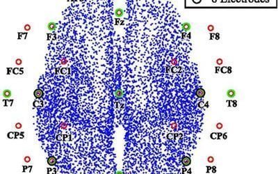 الکتروانسفالوگرافی (EEG) با تراکم بالا، یک الگوی تصویربرداری پویا را به ارمغان می آورد