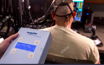 tDCS و تحریک اعصاب محیطی: فاکتوری مداخله گر در مطالعات