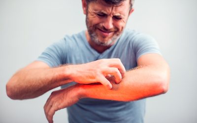 خارش و اگزما! پای سیستم دفاعی و عصبی در میان است.