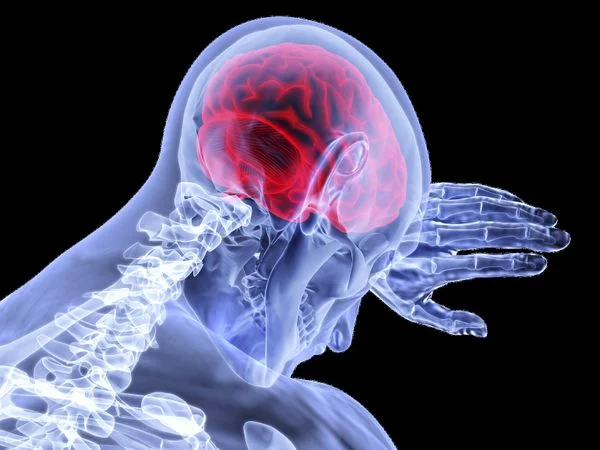بیماری ام اس، حمله سیستم ایمنی به یک گروه از عزیزترین سلول های بدن