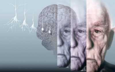 یک قدم نزدیک تر به آلزایمر!