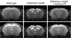 رژیم غذایی مناسب بیماران آلزایمر! بهترین کلینیک درمان آلزایمر در شیراز | سلامت مغز | Dr.Kh.Rahimi Jaberi | 1