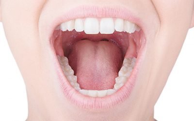امتیاز Mallampati و پیش بینی آپنه خواب