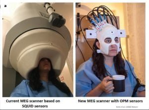 nwe MEG