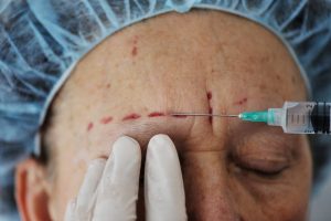 ارتباط بین تزریق بوتاکس و اضطراب؟! | سلامت مغز | Dr.Kh.Rahimi Jaberi | 3
