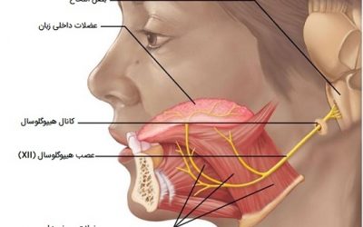 تحریک عصب هیپوگلوسال (عصب زیر زبانی) راهی برای درمان آپنه انسدادی خواب