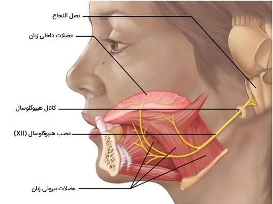 تحریک عصب هیپوگلوسال (عصب زیر زبانی) راهی برای درمان آپنه انسدادی خواب