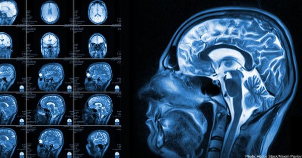 کاگنوسکوپی چیست؟ 4 کاگنوسکوپی چیست؟ | سلامت مغز | دکتر علی محمد کمالی (PhD in Neuroscience) | 3