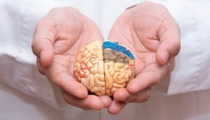 حقایقی مربوط به بیماری آلزایمر! | آلزایمر | Dr.Kh.Rahimi Jaberi | 1