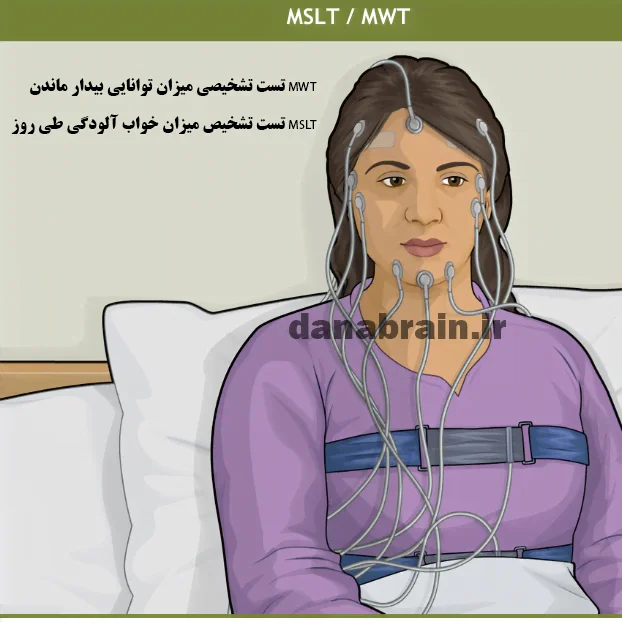 کلینیک خواب شیراز: تست خواب MSLT