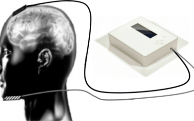 بهبود حافظه با کمک تحریک الکتریکی مغزی یا tDCS در شیراز