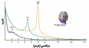 نقشه برداری مغز (qEEG) چگونه به روند درمان آلزایمر کمک میکند؟ | آلزایمر | Mozhan Parsa | 9