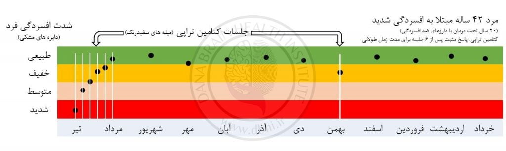 کتامین تراپی 6 کتامین تراپی | | دکتر علی محمد کمالی (PhD in Neuroscience) | 5