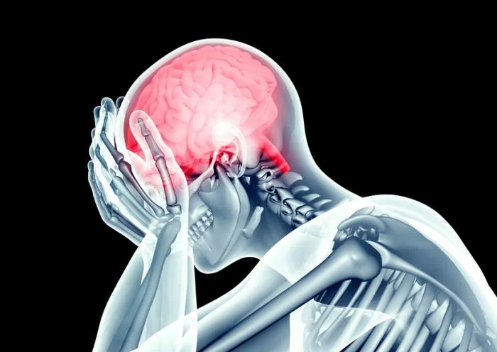 آیا این یک سکته مغزی است یا آنوریسم؟ تفاوت سکته مغزی و آنوریسم مغزی!