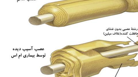 بیماری خود ایمنی و ام اس