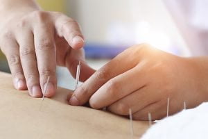 طب سوزنی و ام اس