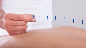 طب سوزنی و ام اس