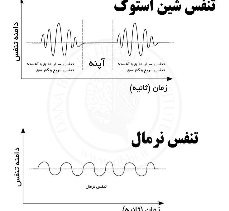 تنفس شین استوک: علل، علائم، تشخیص، درمان