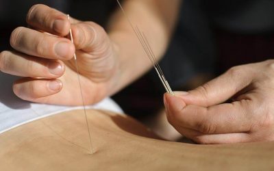 آیا طب سوزنی ممکن است علائم ام اس (مولتیپل اسکلروزیس) را تسکین دهد؟