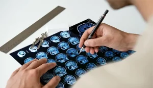 تاثیر ام اس بر بینایی