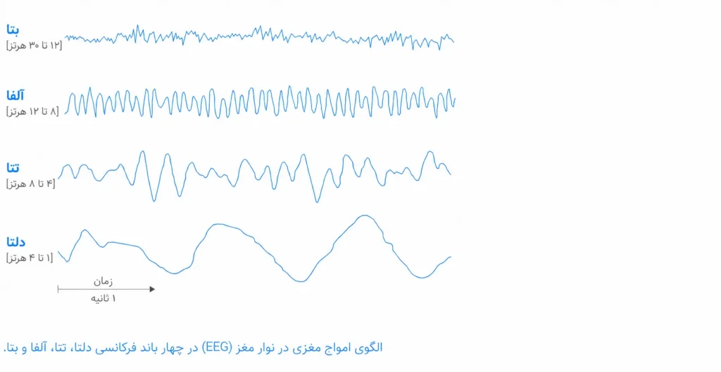نقشه مغزی در شیراز (QEEG) | هزینه ۱۴۰۵، نمونه گزارش و نوبتدهی 10 الگو امواج مغزی و QEEG