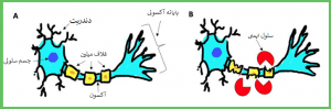 بیماری ام اس در کودکان | سلامت مغز | Dr.Kh.Rahimi Jaberi | 1