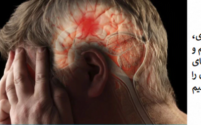 بعد از سکته های مغزی چه اتفاقی می افتد؟ علائم،انواع