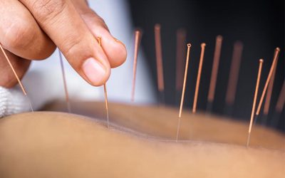 طب سوزنی چیه و دقیقا چطوری در تسکین درد کار می کنه؟