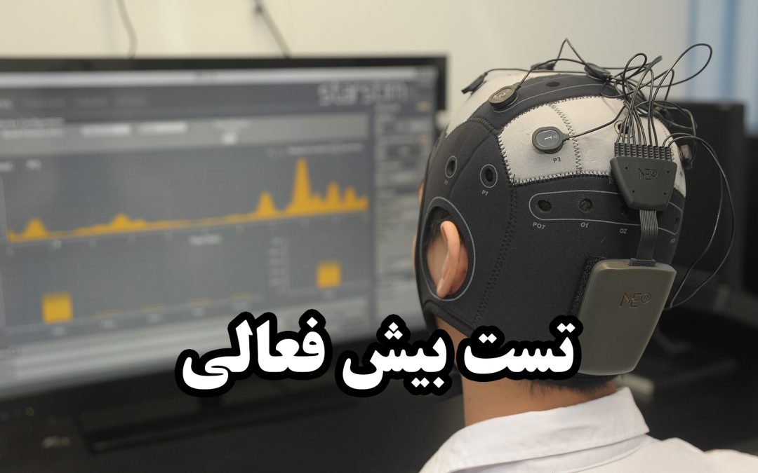 تست بیش فعالی و نقص توجه تمرکز در شیراز