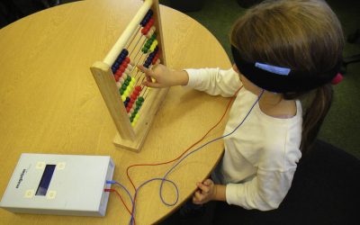 درمان بیش فعالی با tDCS