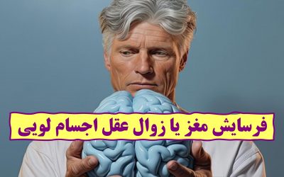 فرسایش مغز یا زوال عقل اجسام لویی