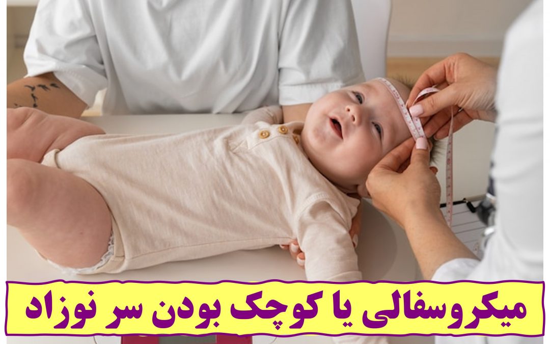 میکروسفالی یا کوچک بودن سر نوزاد