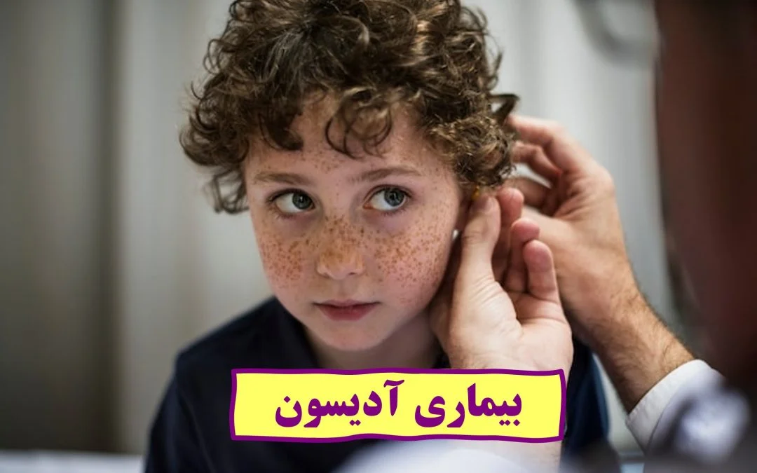 بیماری آدیسون چیست؟