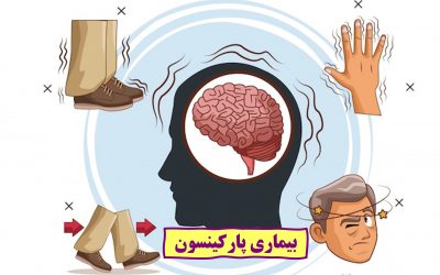 بیماری پارکینسون: علائم، علل، درمان
