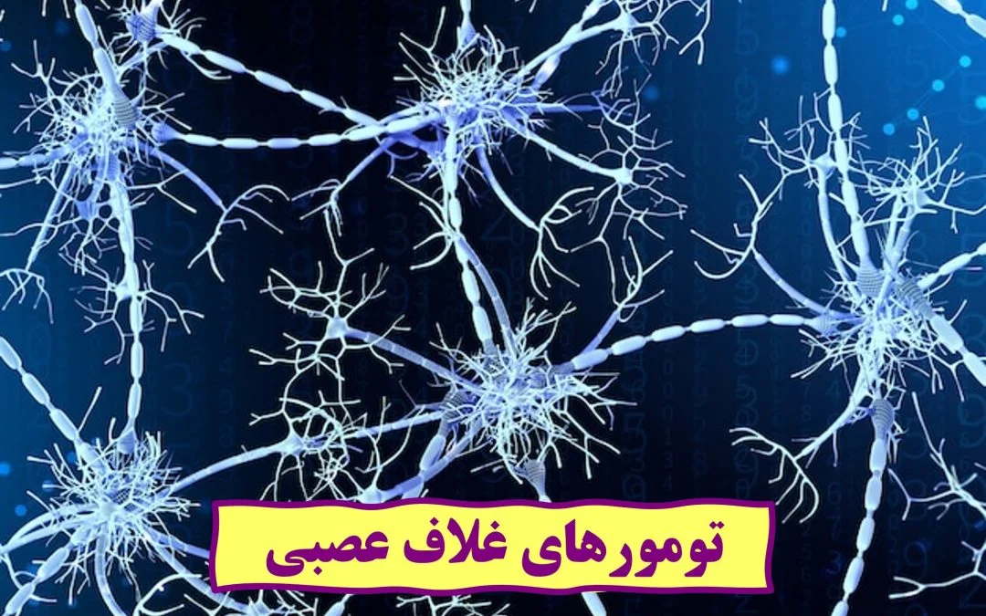 تومورهای غلاف عصبی 