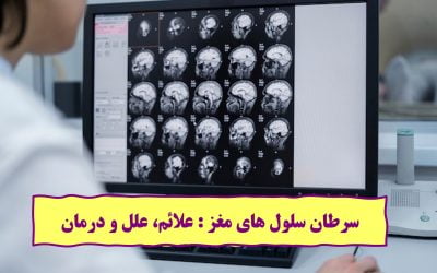 سرطان سلول های مغز: علائم، علل و درمان