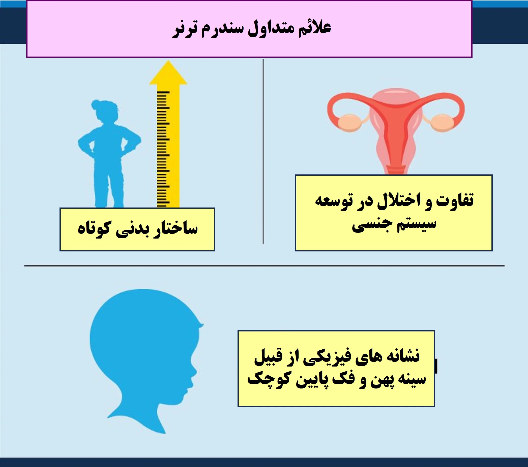 سندرم ترنر