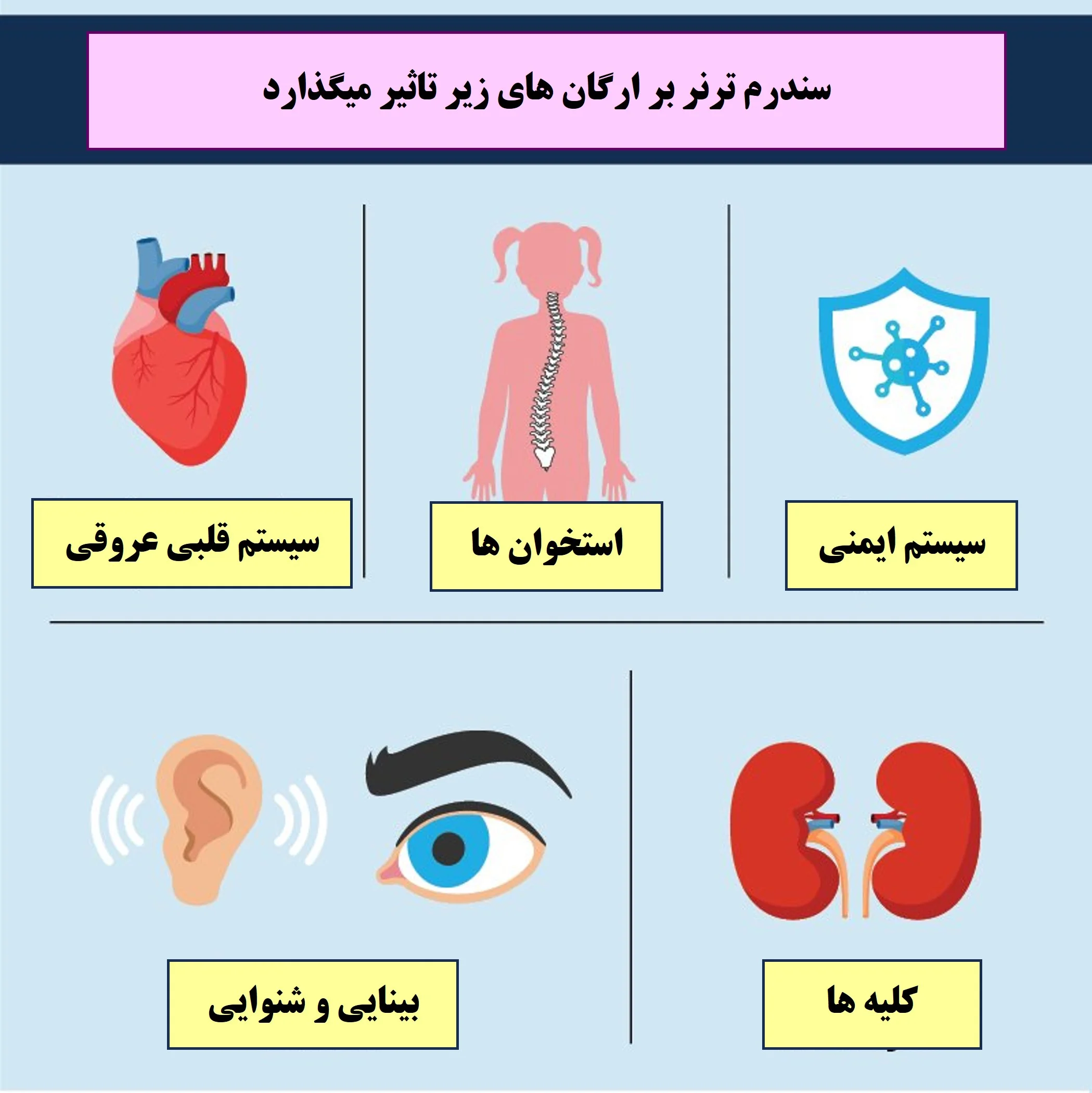 سندرم ترنر