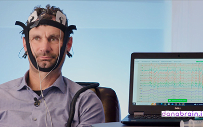 tDCS برای درمان افسردگی (واقعیت یا شعار!)