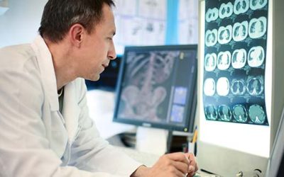بهترین دکتر آلزایمر و فراموشی در شیراز کیست؟