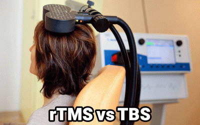 تحریک انفجار تتا (TBS) برای درمان افسردگی