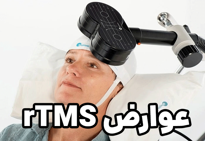 منبع جامع ایمنی و عوارض دستگاه rTMS