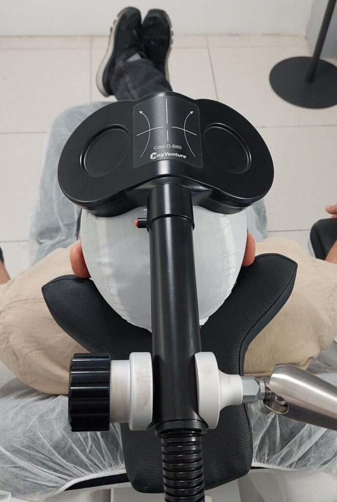 کویل تخصصی دبل کون (Double Cone) برای درمان وسواس (OCD) با تحریک عمقی مغز در شیراز