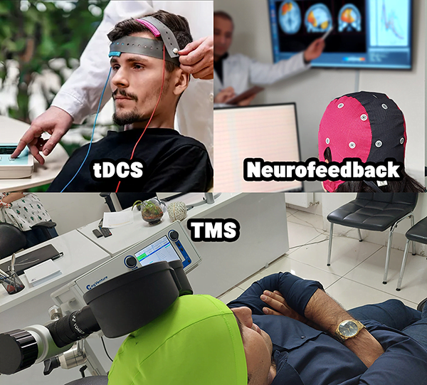 مقایسه نوروفیدبک، tDCS و TMS: بررسی مکانیسم‌ها و تاییدیه‌ها