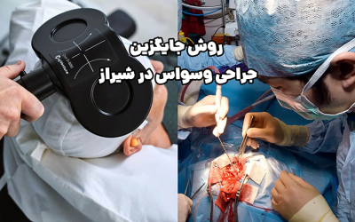 روش جایگزین جراحی وسواس در شیراز
