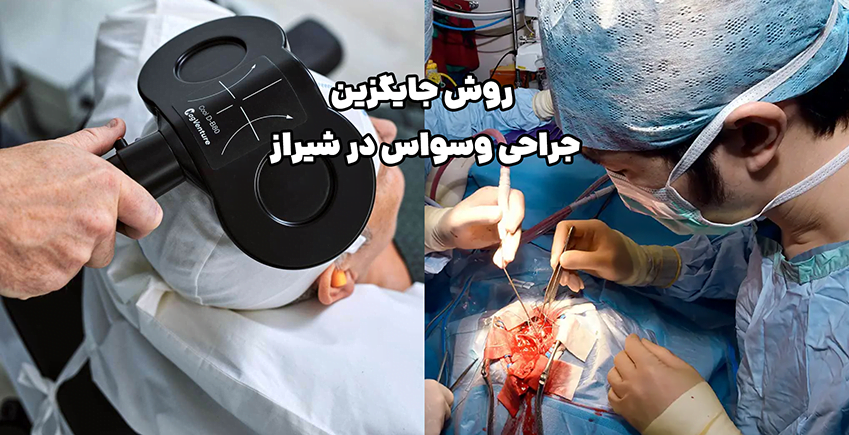روش جایگزین جراحی وسواس در شیراز