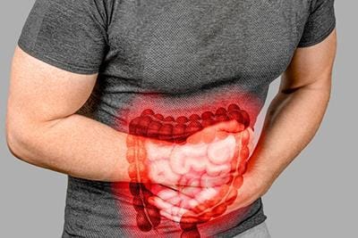 متخصص سندرم روده تحریک پذیر در شیراز