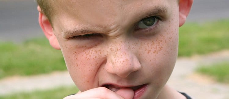 برای تیک عصبی به چه دکتری مراجعه کنیم؟